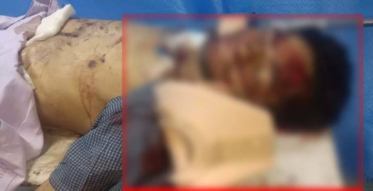 AIIMS हॉस्पिटल की तीसरी मंजिल से गिरकर मरीज की मौत, पुलिस जांच में जुटी