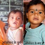 शासन की योजना से दूर हुई बेटी के भविष्य की चिंता, चिरायु दल ने लौटाई मासूम रंजना की मुस्कान