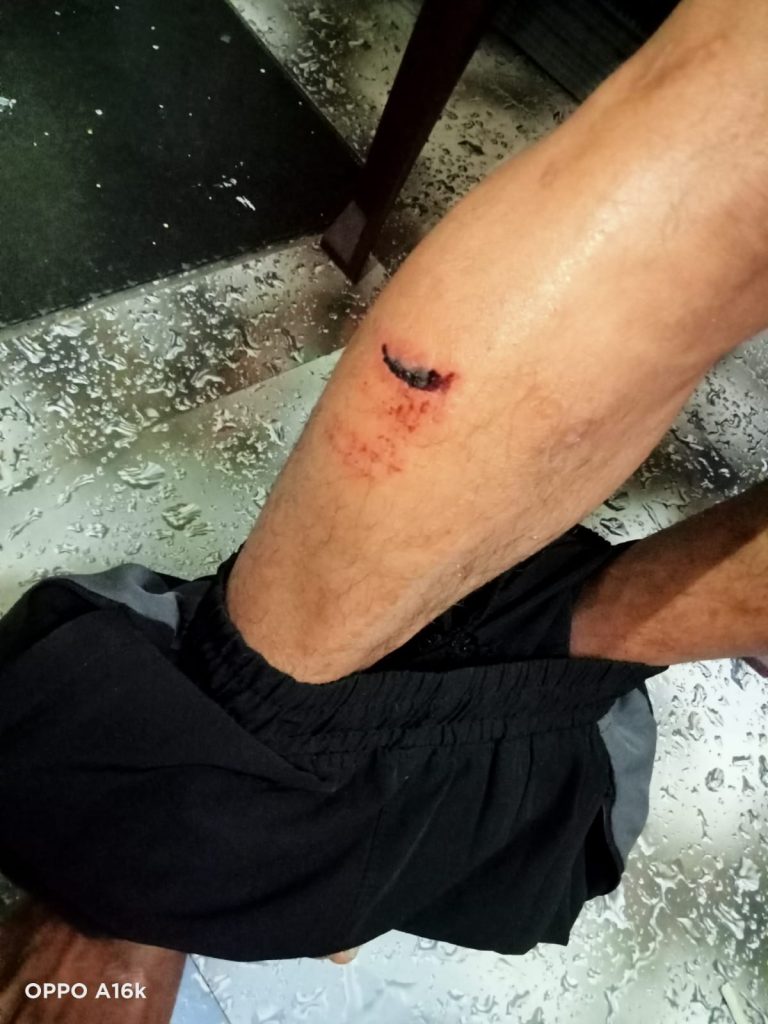 पारस नगर में चाकूबाजी, पुरानी रंजिश में युवक पर जानलेवा हमला; दो आरोपी गिरफ्तार