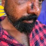 4 बदमाशों ने सुपरवाइजर को चाकू मारकर लूटे पैसे, एक संदेही हिरासत में