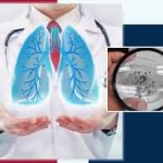 आप भी है हवा में माइक्रोप्लास्टिक्स के खतरे से है परेशान, तो फेफड़ों की सुरक्षा के लिए अपनाये आयुर्वेद प्राकृतिक उपाय