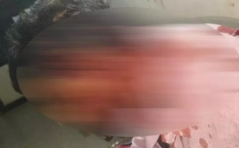 रायपुर एयरपोर्ट के बाहर ऑटो चालक पर हमला, गंभीर रूप से घायल