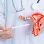 PCOS से जूझ रही महिलाओं के लिए जरूरी गाइड: लक्षण पहचानें और बदलें अपनी डाइट