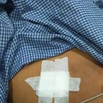 पुलिस की बड़ी कार्रवाही : मंदिर परिसर में चाकूबाजी, भाठागांव का मामला आया सामने