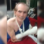 बालको वेदांता संयंत्र में हादसा: ग्राइंडर मशीन से श्रमिक की तीन उंगलियाँ कटीं, सुरक्षा व्यवस्था पर सवाल