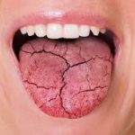 भीषण गर्मी में मुंह सूखने की समस्या: वजह और राहत पाने के तरीके