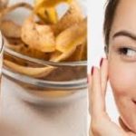 गर्मी के धूप से स्किन हो गई है टैन, तो आलू का रस इस समस्या से देगा राहत