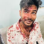 तेलीबांधा में युवक पर चाकू से हमला, पुरानी रंजिश में वारदात