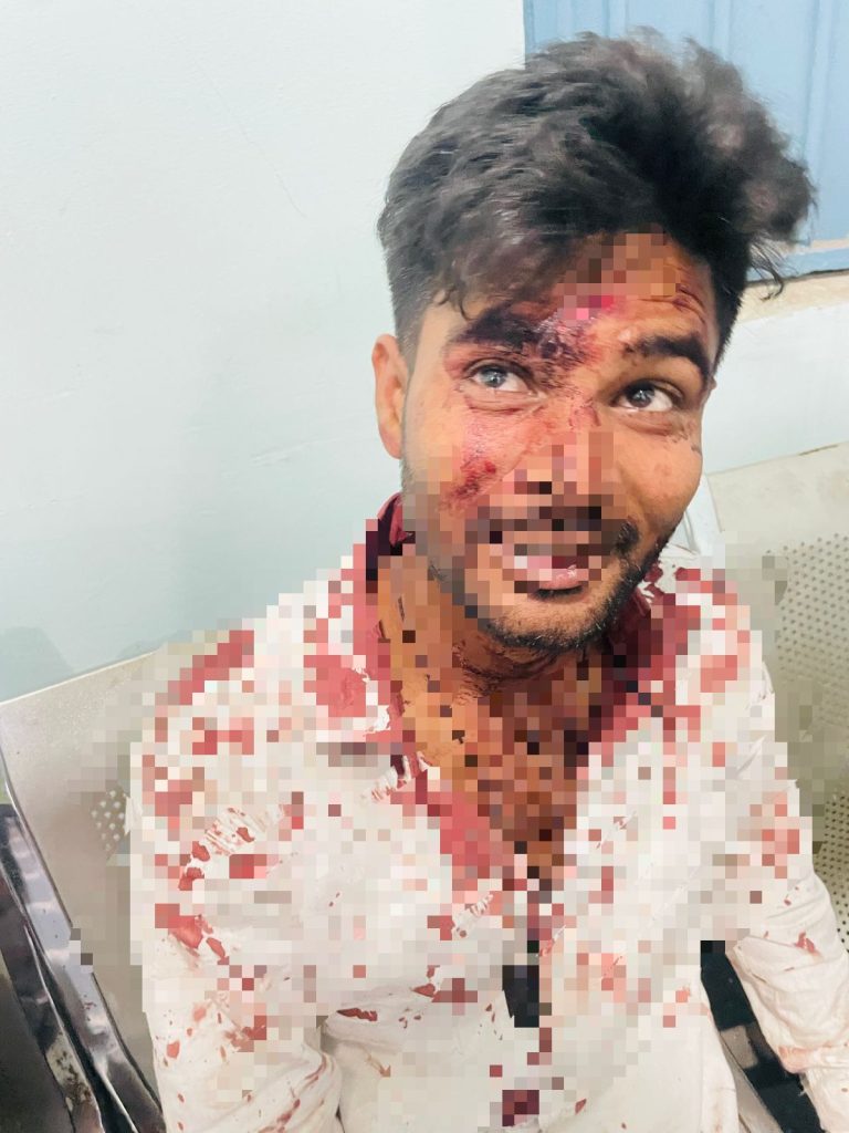 तेलीबांधा में युवक पर चाकू से हमला, पुरानी रंजिश में वारदात