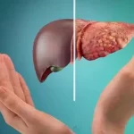Fatty Liver में कौन सा तेल है सबसे बेस्ट? बदलें अपनी कुकिंग, सुधारें अपनी सेहत