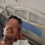अंधविश्वास में खौफनाक कदम: छतरपुर में शख्स ने कुल्हाड़ी से काटा अपना प्राइवेट पार्ट, वजह जान डॉक्टर हैरान