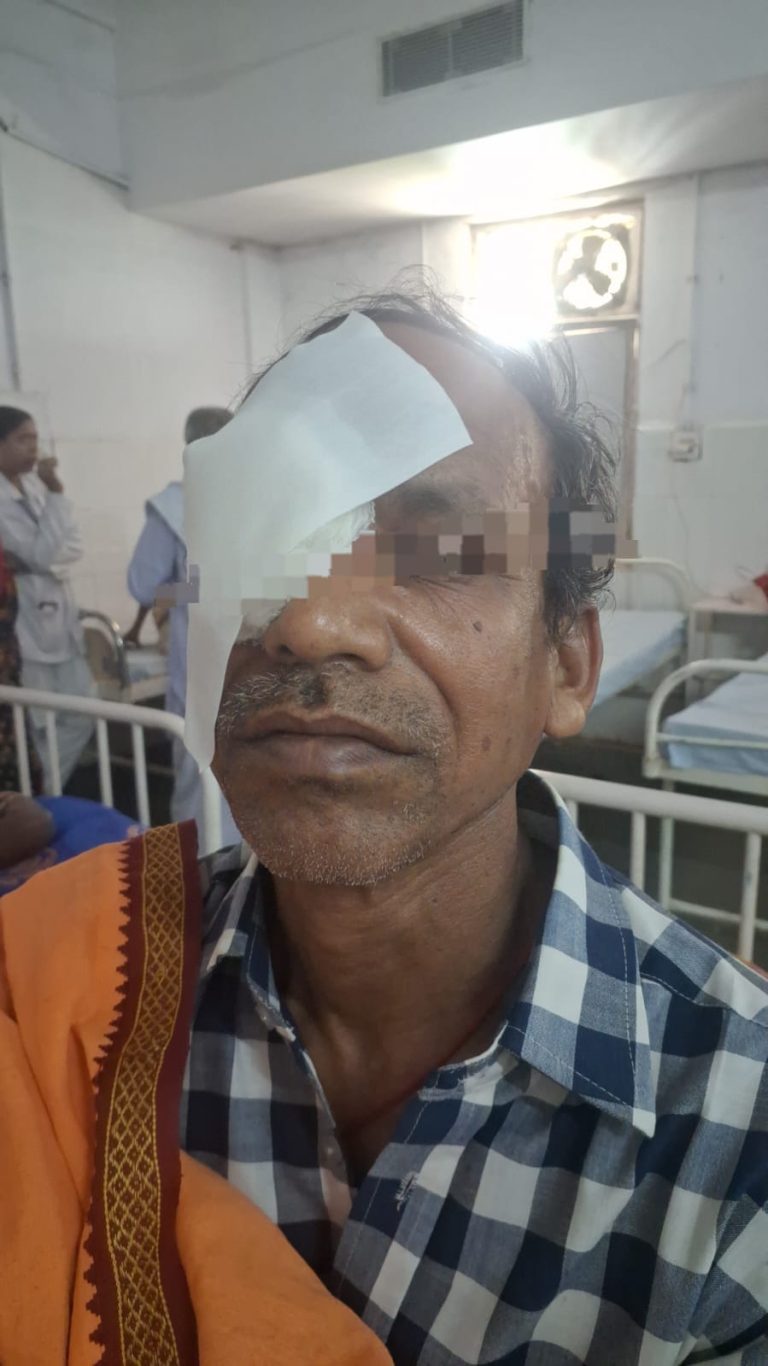 मुख्यमंत्री स्वस्थ बस्तर अभियान से मिली नई रोशनी, कांकेर जिले में 21 मोतियाबिंद मरीजों का हुआ सफल ऑपरेशन