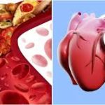 Heart Health: बस एक बदलाव और आपका दिल रहेगा एकदम फिट, जानें क्या है वो ‘दुश्मन’ चीज़?