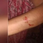 रायपुर में महिला से घर में घुसकर मारपीट, टिकरापारा पुलिस ने शुरू की जांच