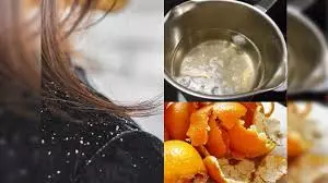 नारियल तेल में मिलाएं ये 3 चीजें, बालों की कई समस्याओं से मिलेगा छुटकारा