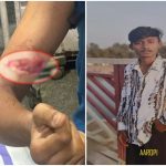 रायपुर में नाबालिग पर ब्लेड से हमला, आरोपी गिरफ्तार; गुढ़ियारी थाना पुलिस की कार्रवाई
